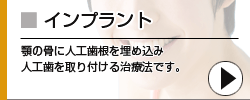 インプラント